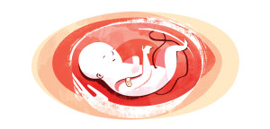 Fetal Surgery Illustration by Nicolet Schenck